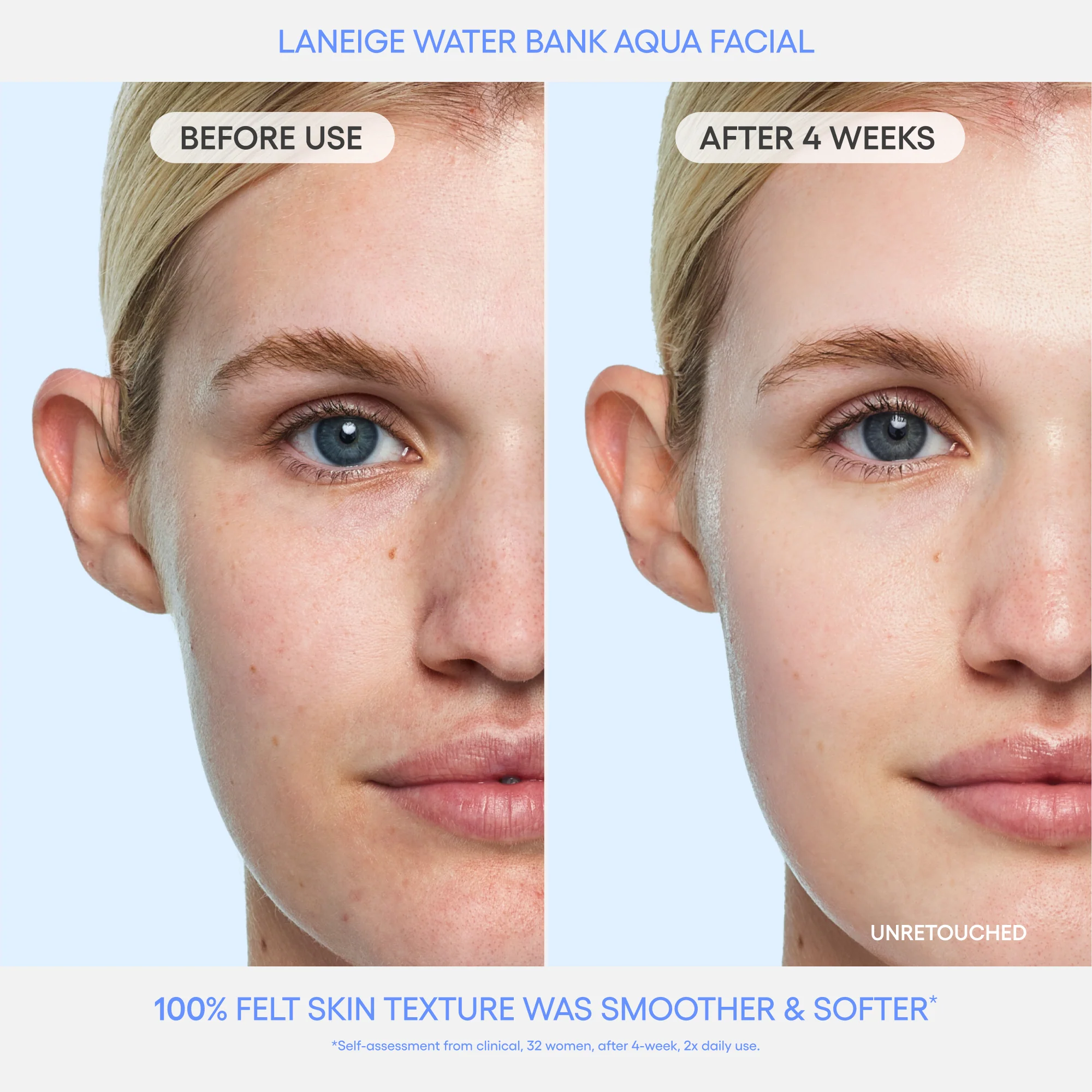 Glass Skin & Soft Lip Duo - Image 4